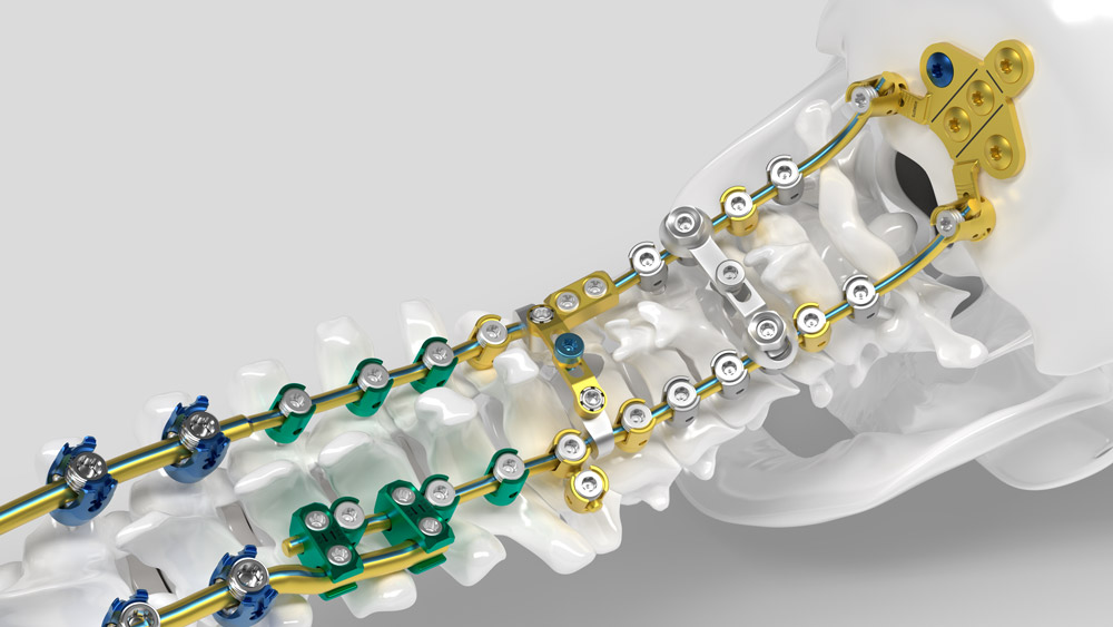 Hirurgija kičme spine surgery Ennovate Cervical Aesculap