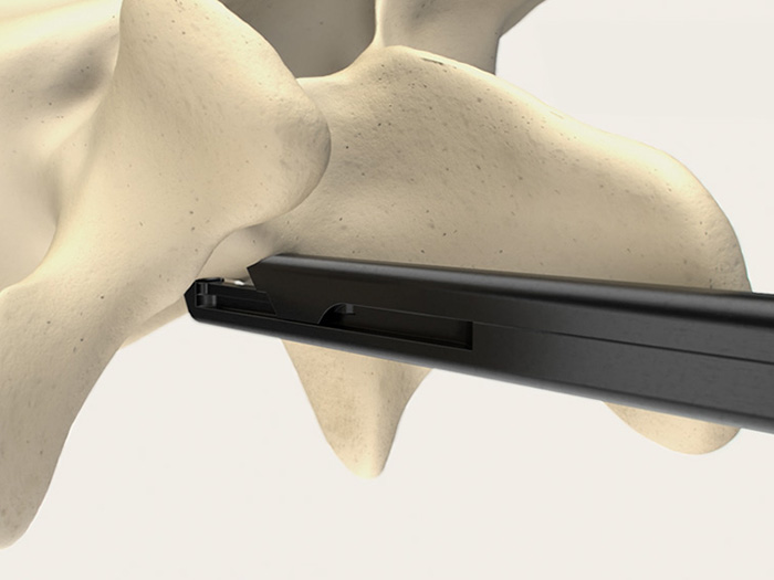 SQ.line Kerrison instrumenti za neurohirurgiju Aesculap