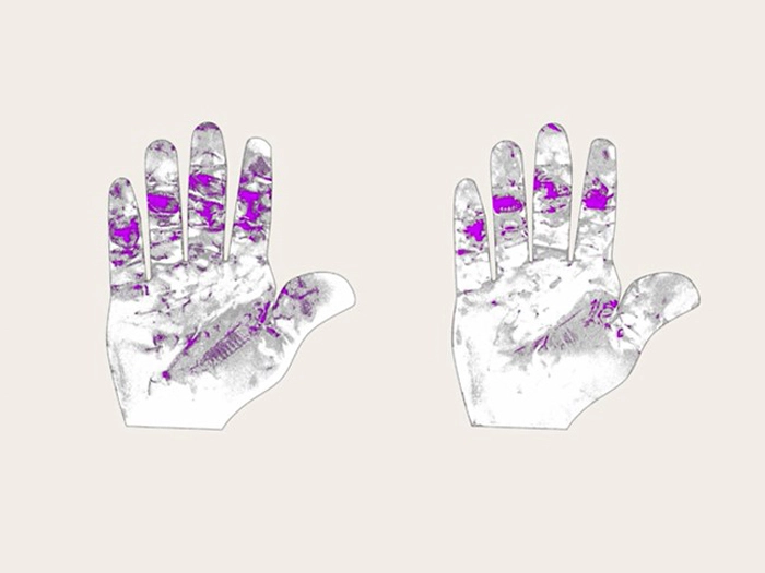 Neurohirurgija instrumenti Kerrison Aesculap